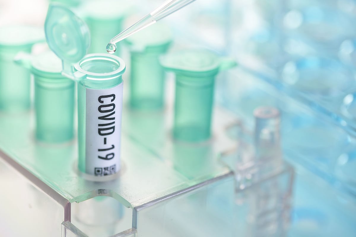 202003_coronavirus_test
